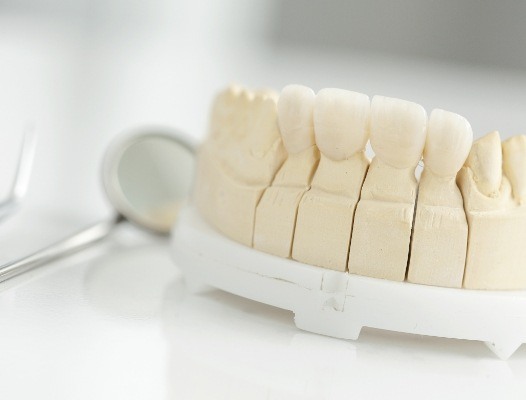 Model smile with metal free dental crowns