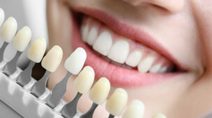 a dental shade chart in front of a smile