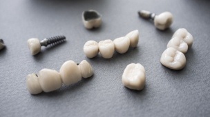 Several types of dental implant restorations