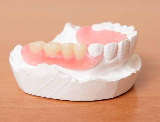 Model smile with partial denture