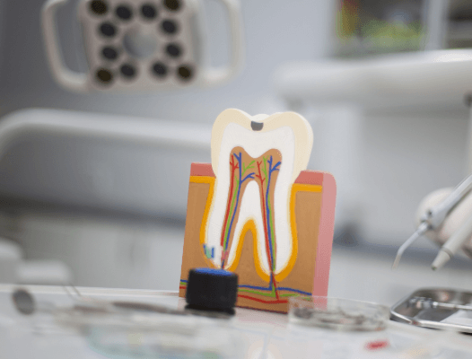 Model of the inside of a tooth and root canals