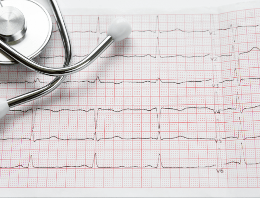 Sleep apnea test reports