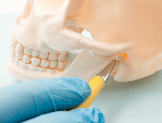 Model of jaw and skull bone used to demonstrate T M J disorder