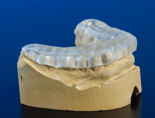 Model smile with occlusal splint to provide T M J therapy