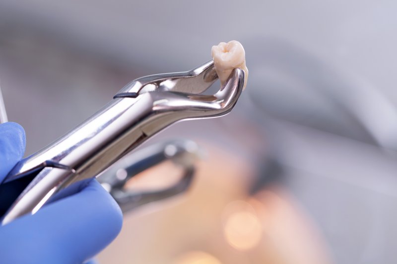 A pair of dental pliers holding an extracted tooth